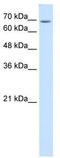 Ubiquitin Specific Peptidase 48 antibody, TA336030, Origene, Western Blot image 