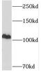 Ubiquitin Specific Peptidase 11 antibody, FNab09306, FineTest, Western Blot image 