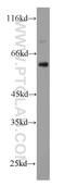 Serine protease inhibitor A3K antibody, 55480-1-AP, Proteintech Group, Western Blot image 