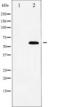 Nuclear Factor, Erythroid 2 Like 2 antibody, TA325714, Origene, Western Blot image 