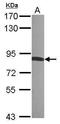 Radixin antibody, TA308208, Origene, Western Blot image 