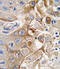 Cytochrome P450 2W1 antibody, abx033684, Abbexa, Immunohistochemistry paraffin image 