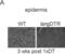 CD207 Molecule antibody, DDX0362P-100, Novus Biologicals, Immunohistochemistry paraffin image 