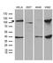 L3MBTL Histone Methyl-Lysine Binding Protein 3 antibody, TA809709, Origene, Western Blot image 