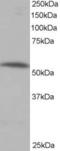 Serine/threonine-protein phosphatase 2A 56 kDa regulatory subunit alpha isoform antibody, EB05234, Everest Biotech, Western Blot image 