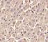 LYN Proto-Oncogene, Src Family Tyrosine Kinase antibody, F52854-0.4ML, NSJ Bioreagents, Immunohistochemistry frozen image 