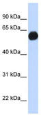 A-Kinase Anchoring Protein 1 antibody, TA341554, Origene, Western Blot image 