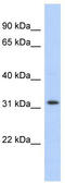 Chromosome 1 Open Reading Frame 131 antibody, TA338833, Origene, Western Blot image 
