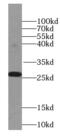 V-Set And Transmembrane Domain Containing 2 Like antibody, FNab09457, FineTest, Western Blot image 
