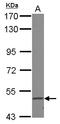 Fatty Acid Desaturase 1 antibody, LS-C155381, Lifespan Biosciences, Western Blot image 