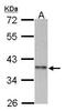 Cyclin I Family Member 2 antibody, TA309068, Origene, Western Blot image 