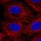 F-Box And Leucine Rich Repeat Protein 3 antibody, HPA065626, Atlas Antibodies, Immunocytochemistry image 