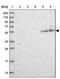 Chromosome 16 Open Reading Frame 70 antibody, NBP1-88454, Novus Biologicals, Western Blot image 