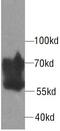 Cell Division Cycle 25B antibody, FNab01522, FineTest, Western Blot image 