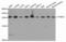 Proteasome Subunit Alpha 2 antibody, LS-C748579, Lifespan Biosciences, Western Blot image 