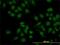 Pseudopodium-enriched atypical kinase 1 antibody, H00079834-M02, Novus Biologicals, Immunofluorescence image 