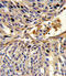 Apurinic/Apyrimidinic Endodeoxyribonuclease 2 antibody, A07203-2, Boster Biological Technology, Immunohistochemistry paraffin image 