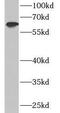 Interferon Induced Protein With Tetratricopeptide Repeats 3 antibody, FNab04138, FineTest, Western Blot image 