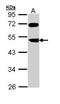 F-box/LRR-repeat protein 3 antibody, PA5-22133, Invitrogen Antibodies, Western Blot image 