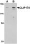 CAP-Gly Domain Containing Linker Protein 1 antibody, NBP1-76921, Novus Biologicals, Western Blot image 