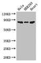 Phosphofructokinase, Muscle antibody, orb46031, Biorbyt, Western Blot image 