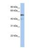 Solute Carrier Family 23 Member 3 antibody, NBP1-59896, Novus Biologicals, Western Blot image 