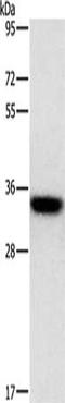 Homeobox protein Hox-B13 antibody, orb519015, Biorbyt, Western Blot image 