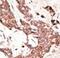 Sirtuin 3 antibody, LS-C100489, Lifespan Biosciences, Immunohistochemistry paraffin image 