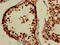Protoporphyrinogen Oxidase antibody, CSB-PA018502LA01HU, Cusabio, Immunohistochemistry paraffin image 