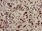 Ubiquitin Specific Peptidase 22 antibody, LS-C673442, Lifespan Biosciences, Immunohistochemistry paraffin image 