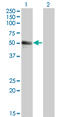 Sialophorin antibody, LS-C198254, Lifespan Biosciences, Western Blot image 