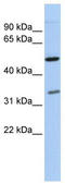 Polyglutamine Binding Protein 1 antibody, TA330229, Origene, Western Blot image 