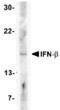 Interferon Beta 1 antibody, AHP1435, Bio-Rad (formerly AbD Serotec) , Western Blot image 