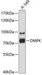 DM1 Protein Kinase antibody, 13-652, ProSci, Western Blot image 