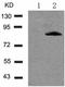 Forkhead Box O1 antibody, TA323072, Origene, Western Blot image 