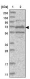 Sosondowah Ankyrin Repeat Domain Family Member B antibody, NBP1-90905, Novus Biologicals, Immunohistochemistry frozen image 