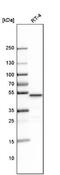 Ligand-dependent corepressor antibody, NBP1-83477, Novus Biologicals, Western Blot image 
