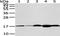 Vesicle Associated Membrane Protein 2 antibody, TA351910, Origene, Western Blot image 