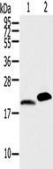 Myosin regulatory light chain 2, ventricular/cardiac muscle isoform antibody, TA349407, Origene, Western Blot image 
