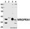 MAS Related GPR Family Member X4 antibody, A16446-1, Boster Biological Technology, Western Blot image 