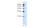 Solute Carrier Family 2 Member 6 antibody, ARP43974_T100, Aviva Systems Biology, Western Blot image 