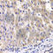 Ribosomal Protein L14 antibody, A6724, ABclonal Technology, Immunohistochemistry paraffin image 