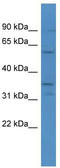 Carbonic Anhydrase 5A antibody, TA342841, Origene, Western Blot image 
