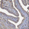 POTE Ankyrin Domain Family Member F antibody, HPA041264, Atlas Antibodies, Immunohistochemistry paraffin image 