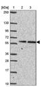 Lamin Tail Domain Containing 2 antibody, PA5-63575, Invitrogen Antibodies, Western Blot image 