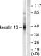KRT18 antibody, TA311742, Origene, Western Blot image 
