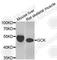 Glucokinase antibody, A6293, ABclonal Technology, Western Blot image 