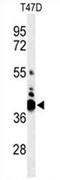 V-Set Domain Containing T Cell Activation Inhibitor 1 antibody, AP54528PU-N, Origene, Western Blot image 