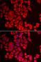 QC antibody, LS-C334897, Lifespan Biosciences, Immunofluorescence image 
