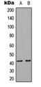 C-C Motif Chemokine Receptor 4 antibody, orb235064, Biorbyt, Western Blot image 